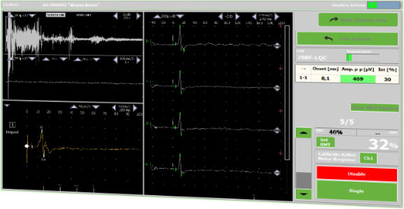 Logiciel DuoMAG rTMS