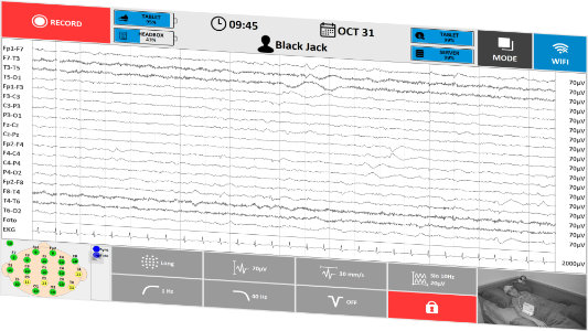 Acquisition EEG TruScan en mode soins intensifs