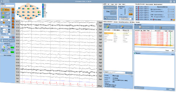 Acquisition EEG TruScan